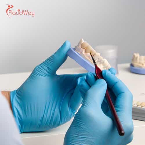 Dental Crowns in Turkey: Affordable and Expert Dental Solutions for Australians